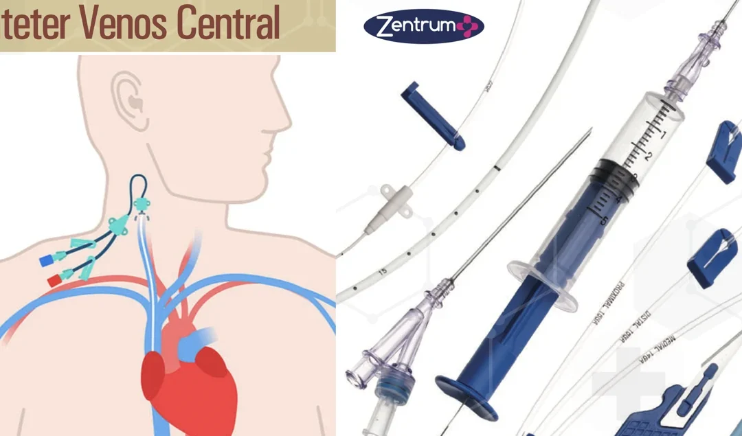 Reducerea riscurilor conectori în ATI: siguranță și prevenirea escarelor