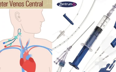 Reducerea riscurilor conectori în ATI: siguranță și prevenirea escarelor