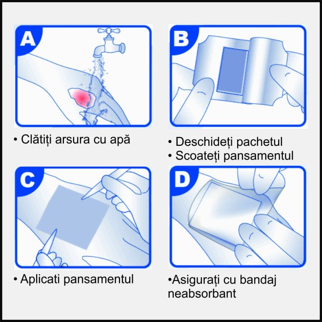  Comprese sterile pentru arsuri impregnate cu hidrogel 20x45 cm