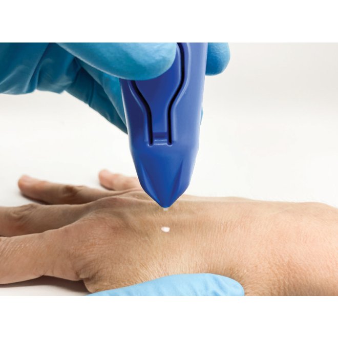 Dispozitiv Criochirurgical Cryomega – Precizie Criogenică cu Cartuș de 16 g