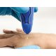 Dispozitiv Criochirurgical Cryomega – Precizie Criogenică cu Cartuș de 16 g